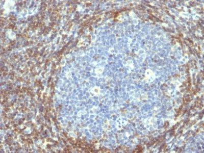Formalin-fixed, paraffin embedded human tonsil sections stained with 100 ul anti-Bcl-2 (clone BCL2/782) at 1:100. HIER epitope retrieval prior to staining was performed in 10mM Tris 1mM EDTA, pH 9.0.
